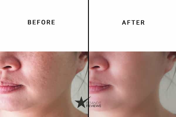 NourishMax Peptide Serum Before and After